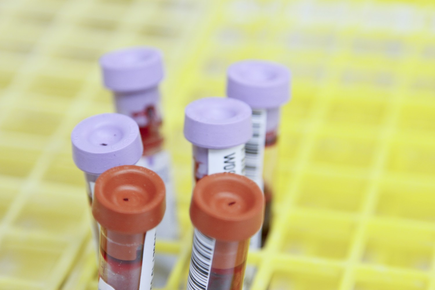 Labelled blood sample tubes arranged in a laboratory rack.